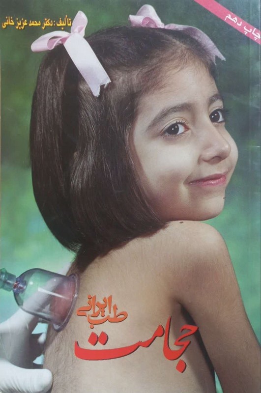 کتاب طب ایرانی، حجامت